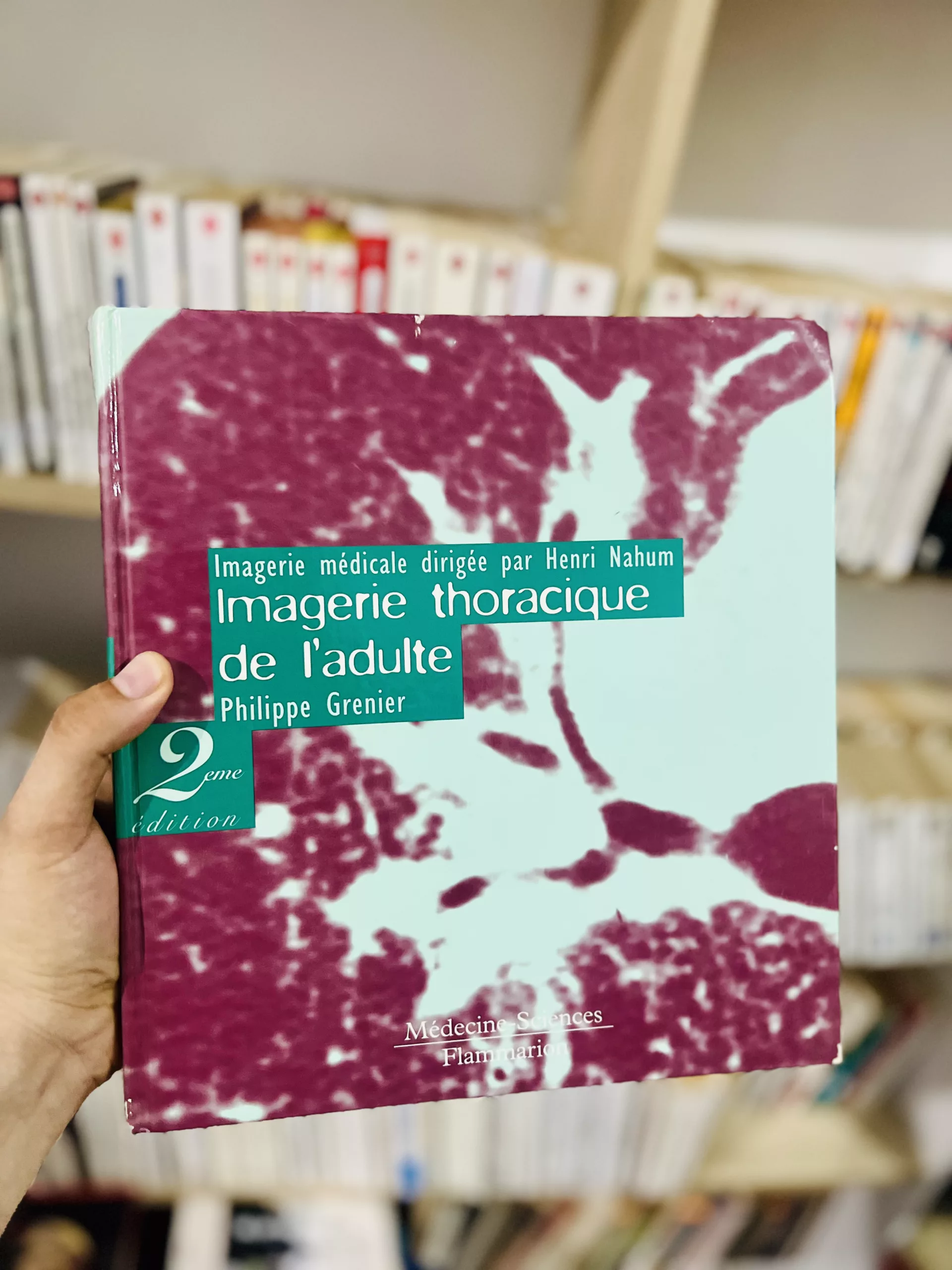 Imagerie Thoracique De L’Adulte. 2eme Edition
