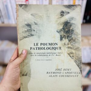 Le poumon pathologique - Atlas de seméiologie radiologique - José Rémy - Capdebville Raymond - Alain Coussement