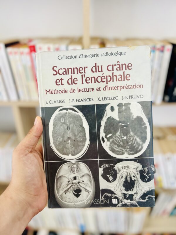 Scanner la crâne et de l'encéphale 1 Scanner la crâne et de l’encéphale