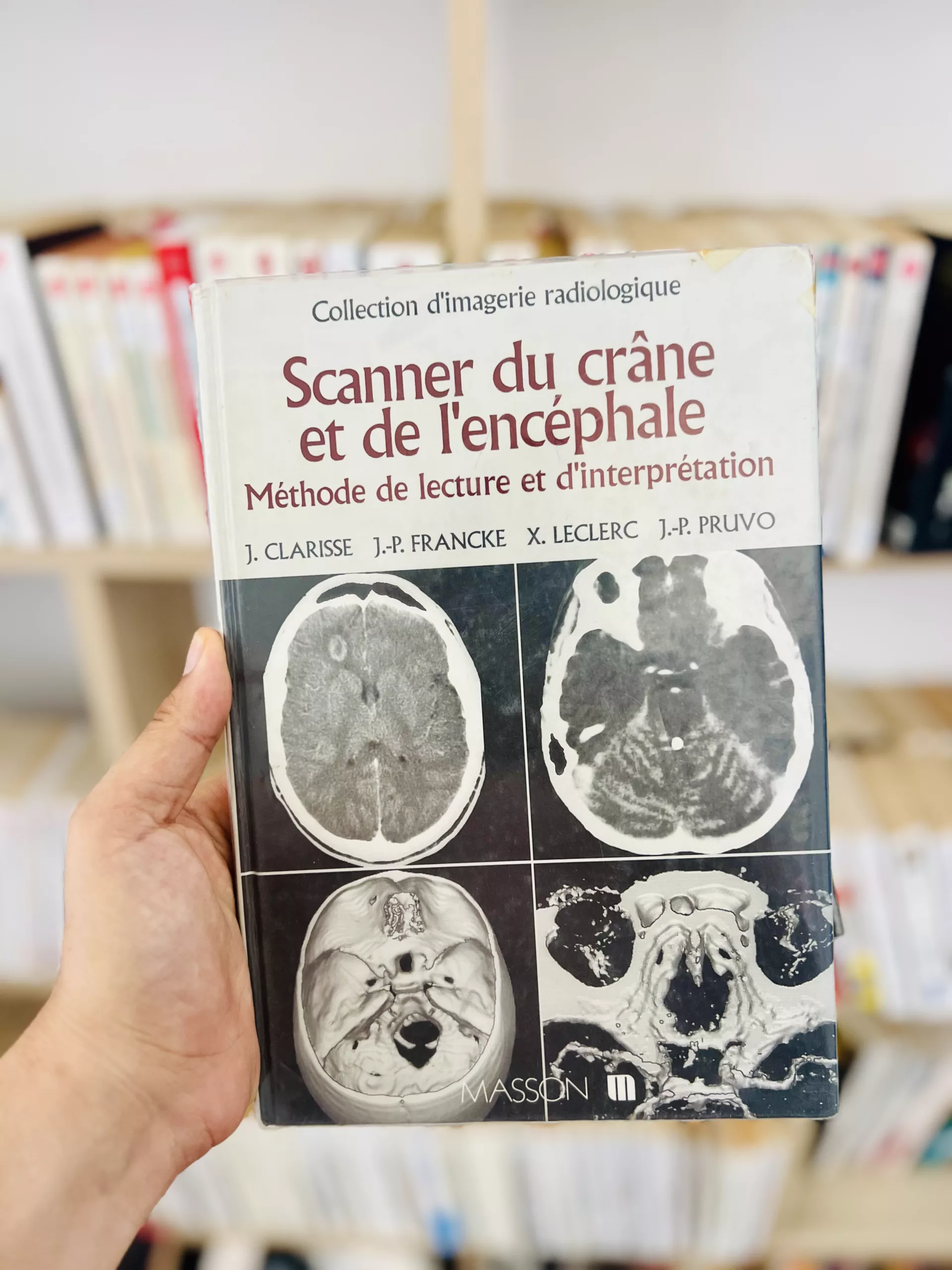 Scanner la crâne et de l’encéphale méthode de lecture et d’interprétation de Jacques Clarisse, Jean-Paul Francke